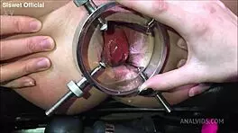 they wrecked her asshole with fisting and bulged her belly in lesbian anal